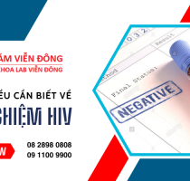 Xét nghiệm HIV và những thông tin cần biết