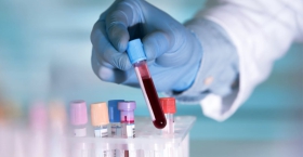 Xét nghiệm HIV